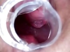 Wife has Speculum Orgasm Contractions 0:46 video on WebcamWhoring.com