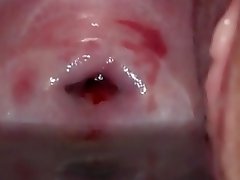 cervix video on WebcamWhoring.com